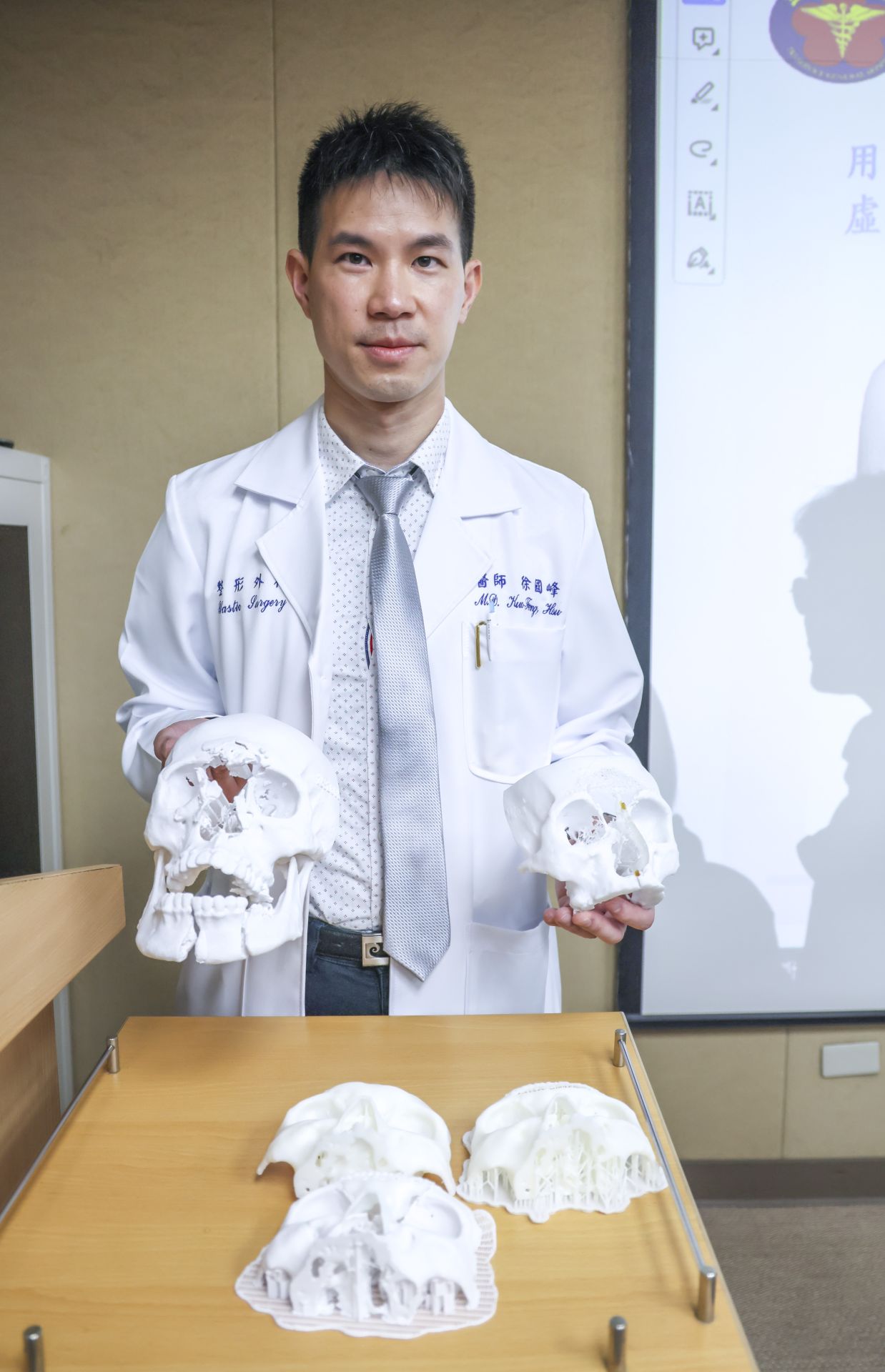 運用3D列印模型輔助手術規劃，可在術前以虛擬重建技術模擬下顎、額鼻骨等結構。（記者范瑜攝）