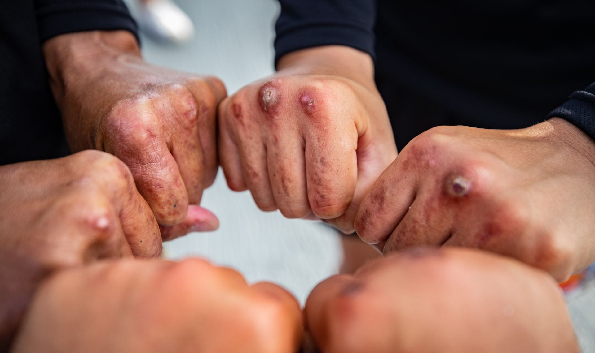  莒拳隊必經的「正拳」訓練，是每位隊員身上的「榮耀印記」。（本報資料照片）