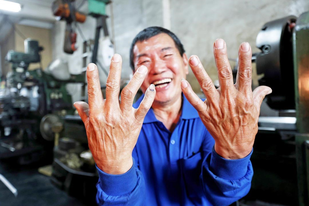 柳新發扭曲的十指，是工作上奮戰的「戰績」。